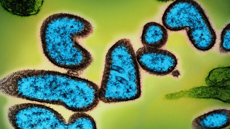 Česko varuje před silně smrtícím virem. Lék dosud neexistuje, příznaky začínají nenápadně